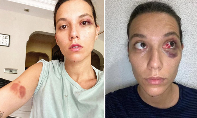 Mekandan kovulan Ozan Güven'e Demet Akalın'dan destek geldi