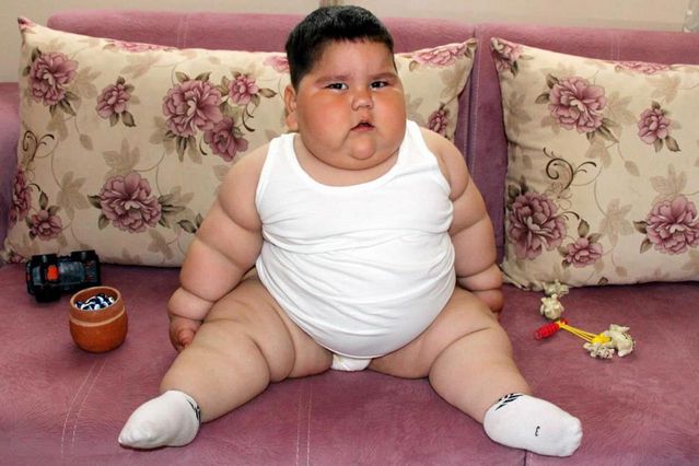 5 yaşındayken 90 kiloydu! Minik Yağız'ın 6 yıl sonraki görenler inanamıyor