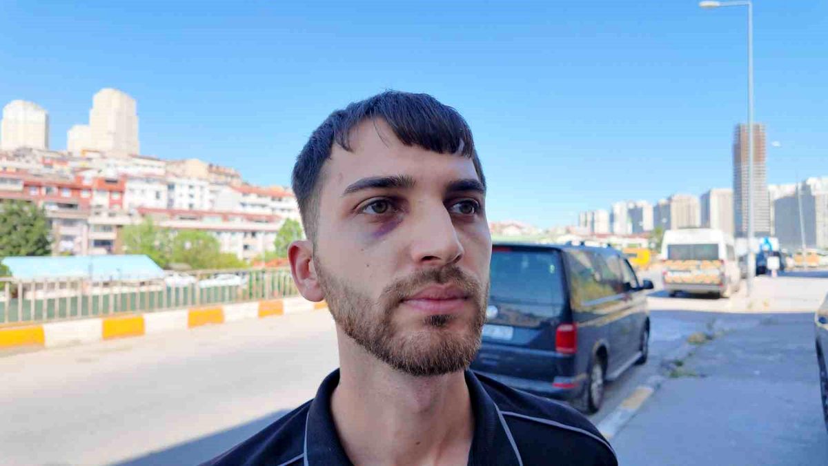 Avcılar\'da Kaza Sonrası Darp Olayı