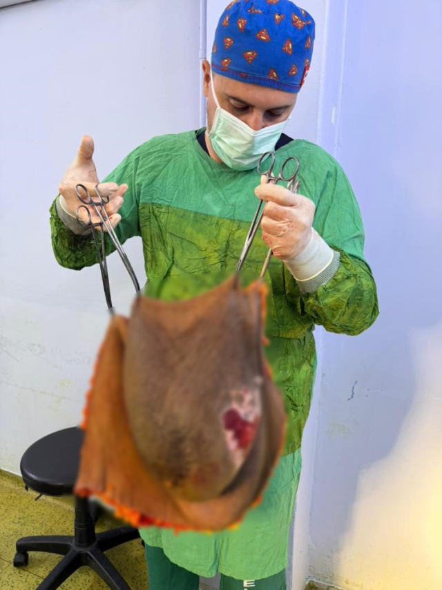 Bu kitle bir insanın karnından çıktı! Doktor tek başına kaldıramadı