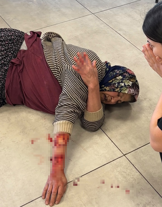 Saldırgan köpek kadının kolunu kopardı