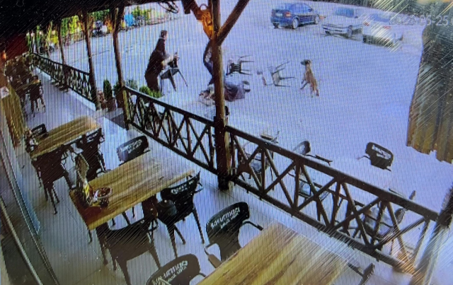 Saldırgan köpek kadının kolunu kopardı