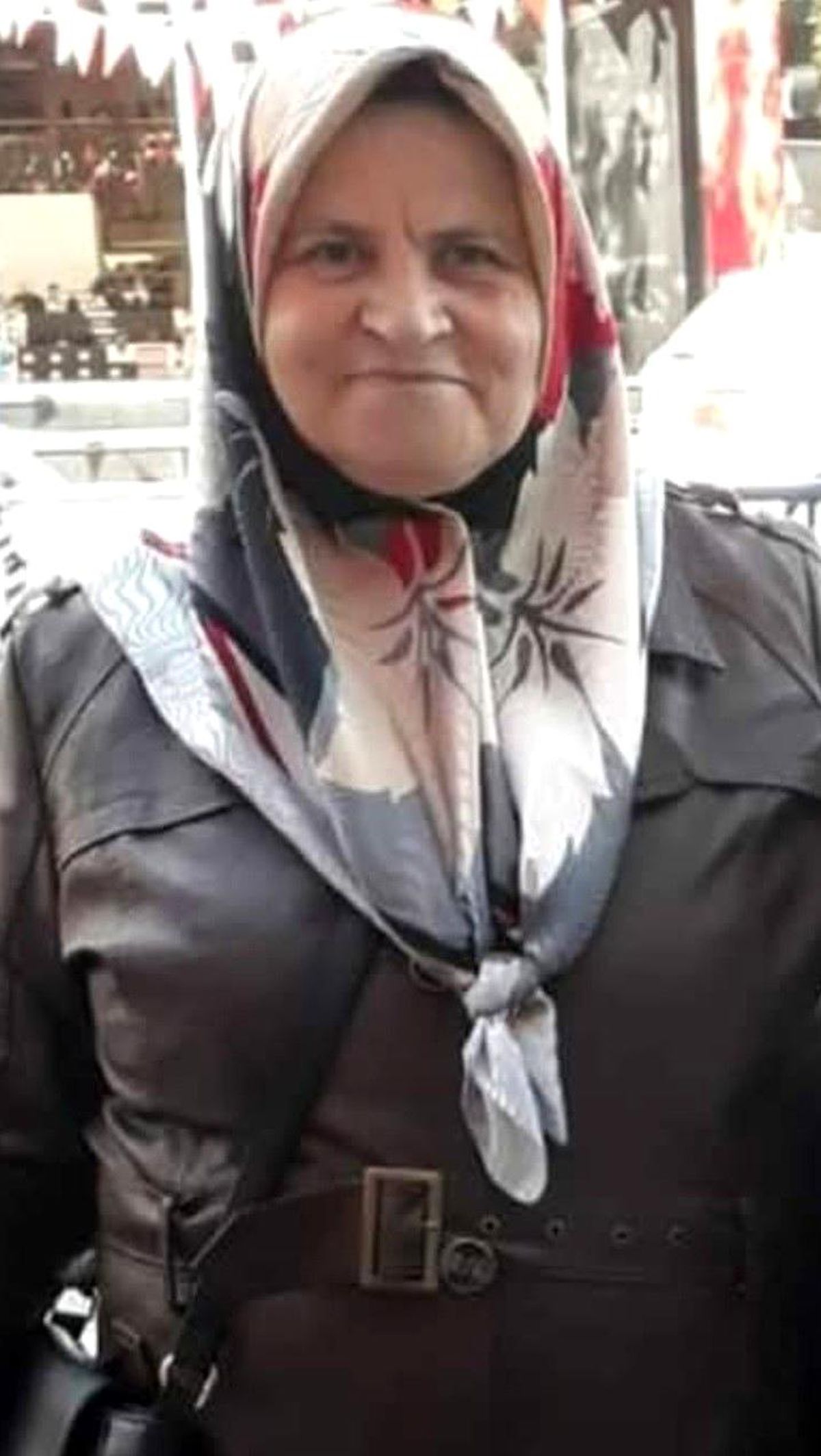 Yangında Yaralanan Kadın Hayatını Kaybetti
