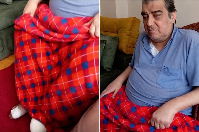Ömer Danış’tan üzen haber: Ayak parmakları kesildi