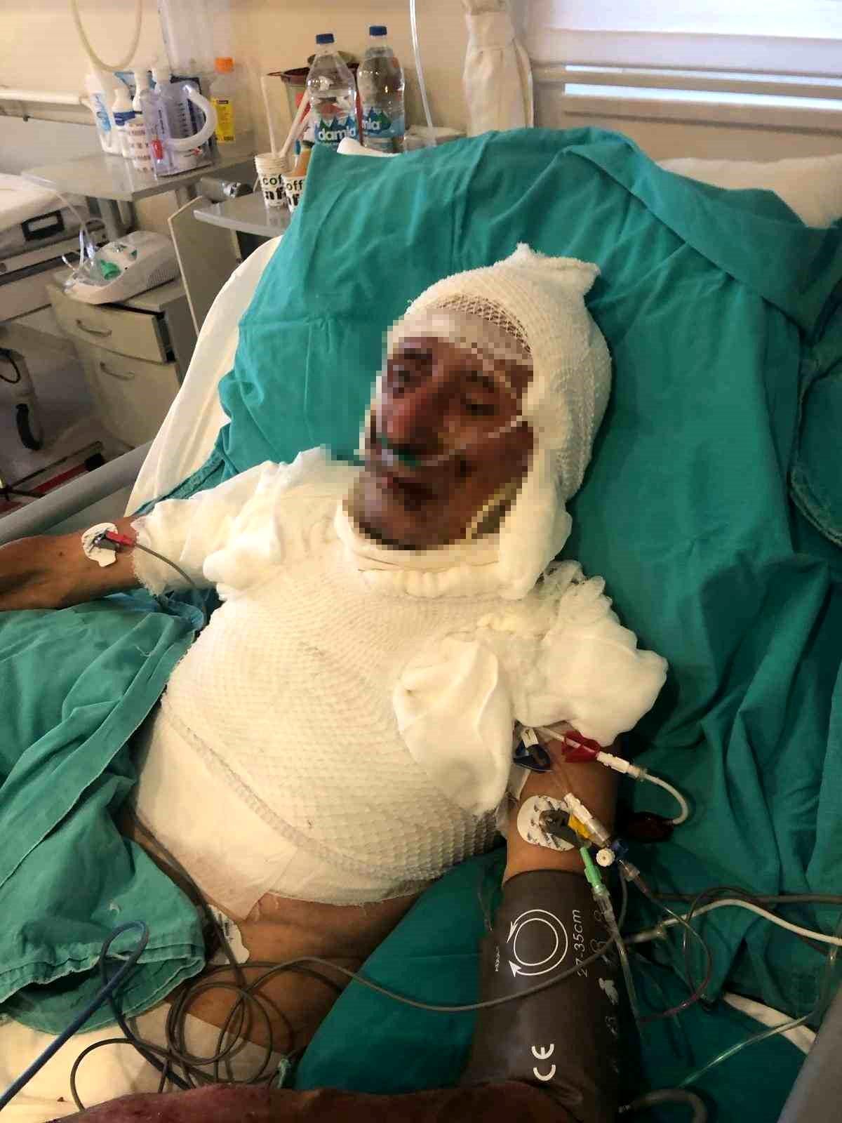 Kardeşini Kilitleyip Yangın Çıkardı, 15 Yıl Hapis Cezası Aldı