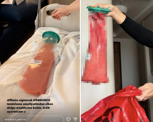 Danla Bilic apar topar ameliyata alındı! Hastane odasından ilk açıklama geldi
