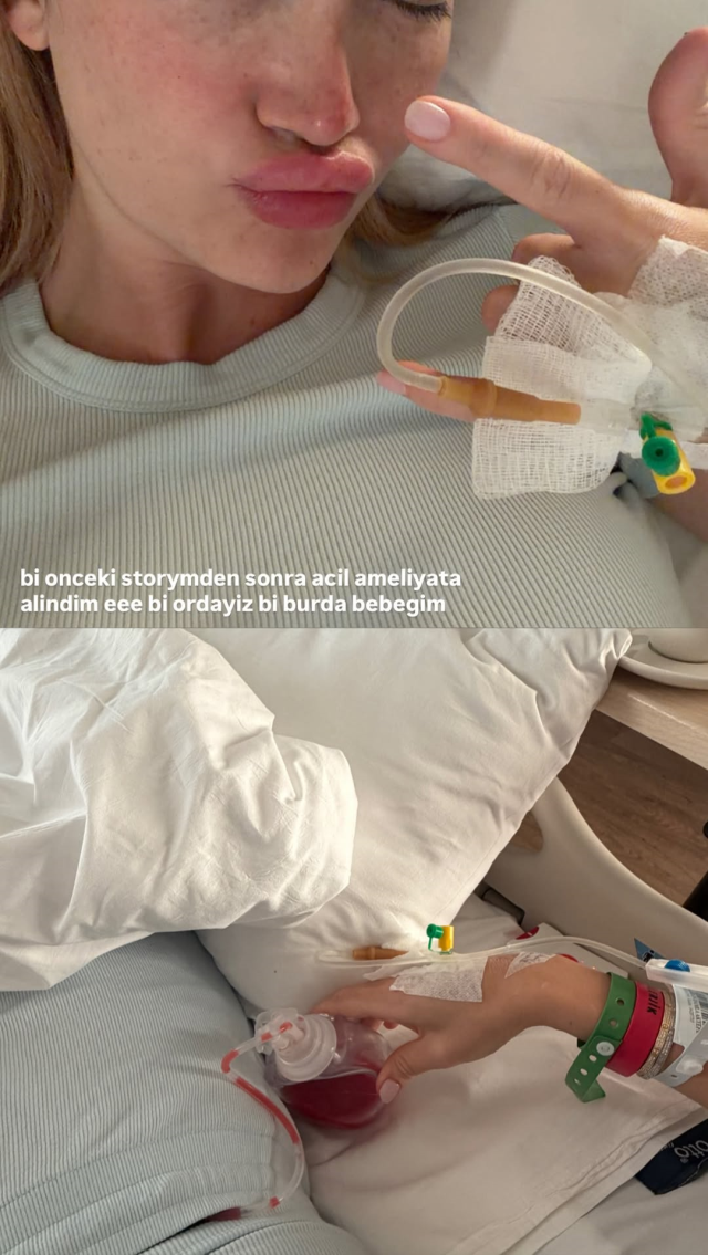 Danla Bilic apar topar ameliyata alındı! Hastane odasından ilk açıklama geldi