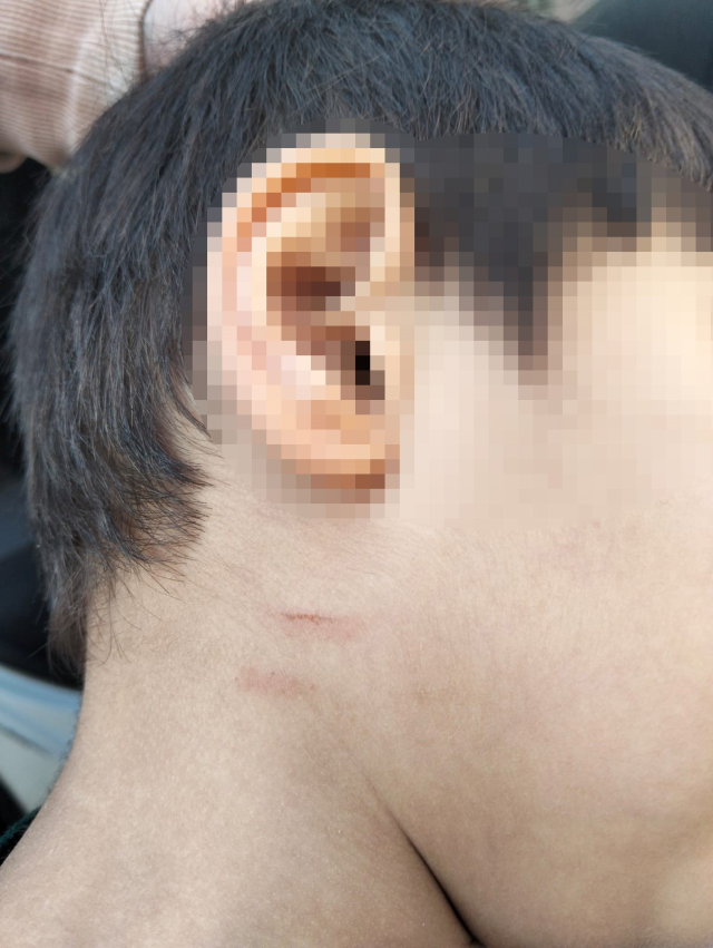 Otizmli çocuğa şiddet kamerada: Öğretmen tutuklandı