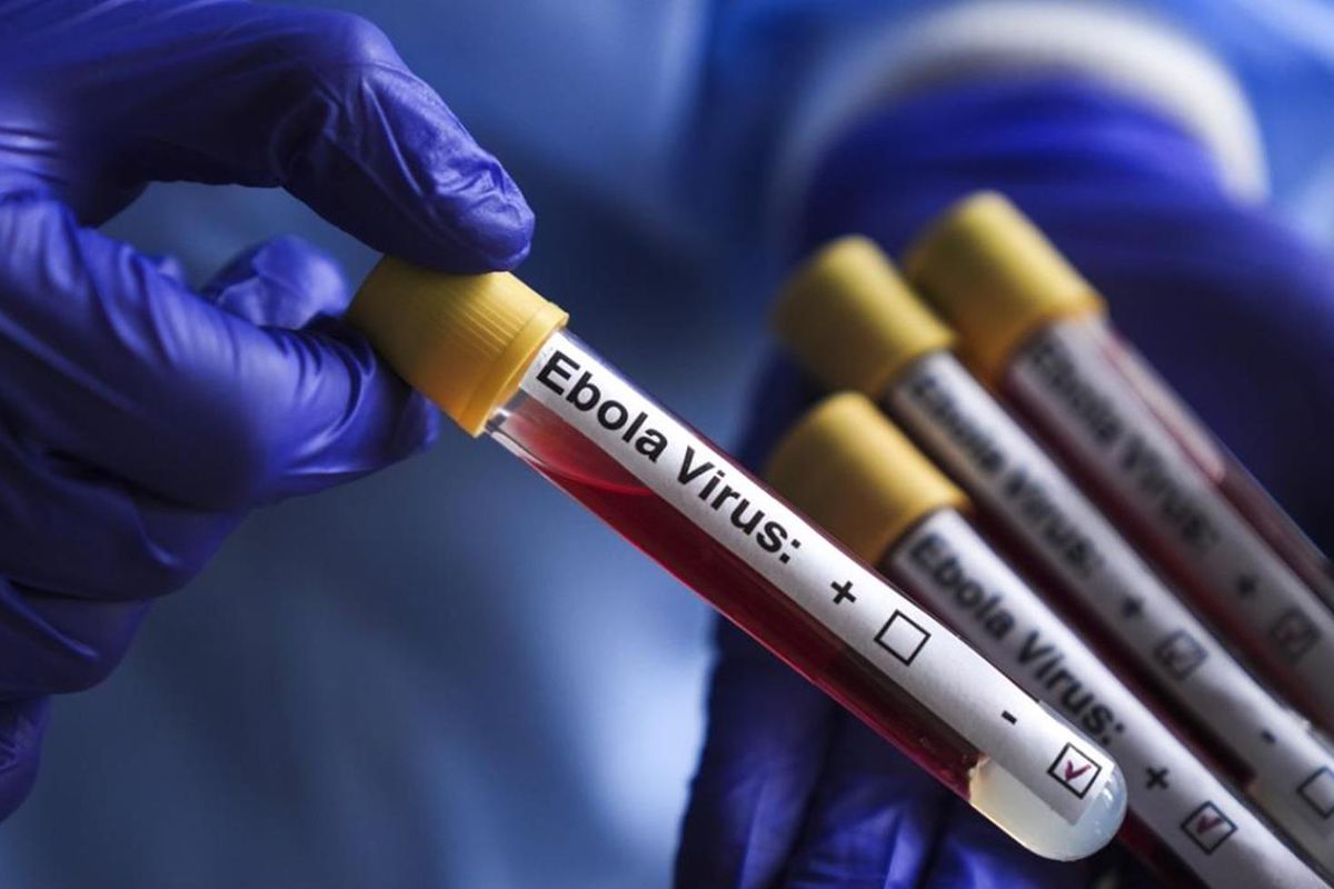 Kongo\'da ebola salgını: 1155 vaka, 304 ölüm