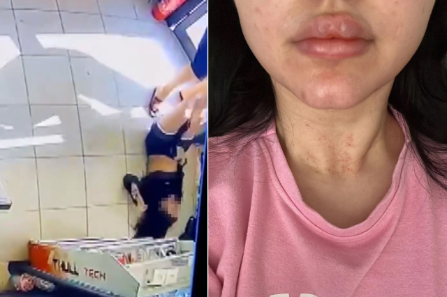 Güpegündüz genç kadına yaptıklarına bakın! Gözü dönmüş saldırgan her yerde aranıyor