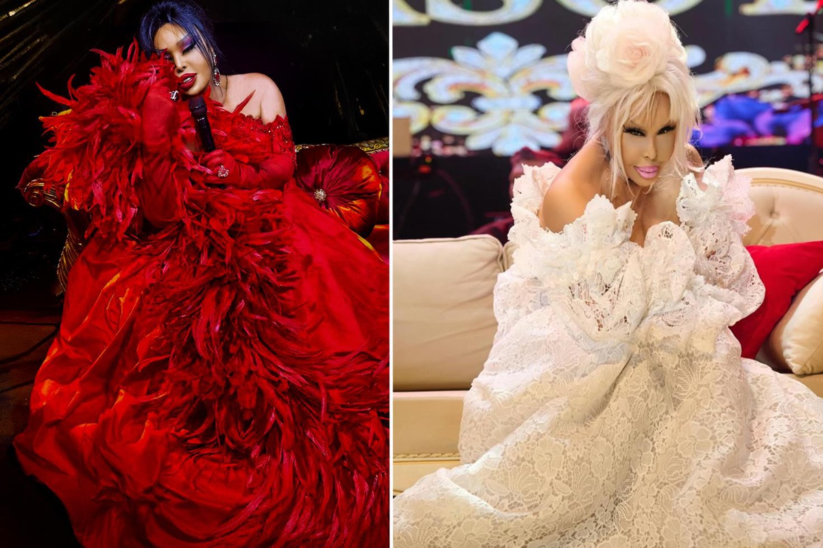 Diva yıllar sonra kural bozdu: Bülent Ersoy estetik ameliyatla gençleşti