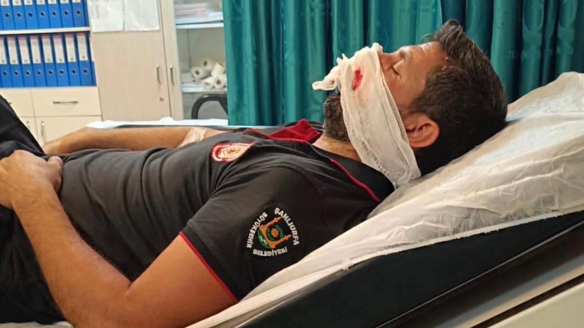 İtfaiye Lastiği Patladı, Personel Yaralandı