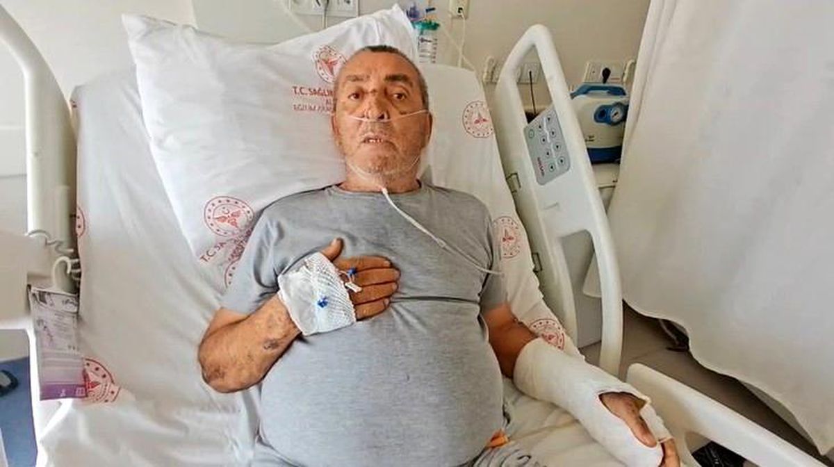 Alanya\'da Motosiklet Kazası: Yaşlı Adam Ağır Yaralandı