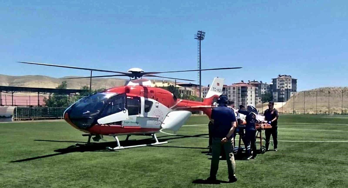İş Kazasında Parmak Kopması