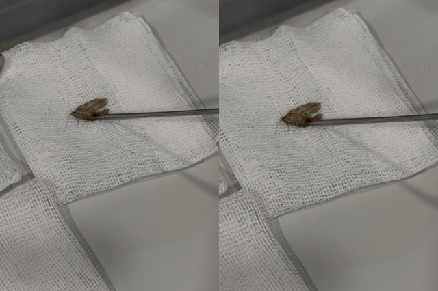 Kulağından canlı olarak çıkarıldı, doktor bile şoke oldu: Hareketliydi, doğaya bıraktık