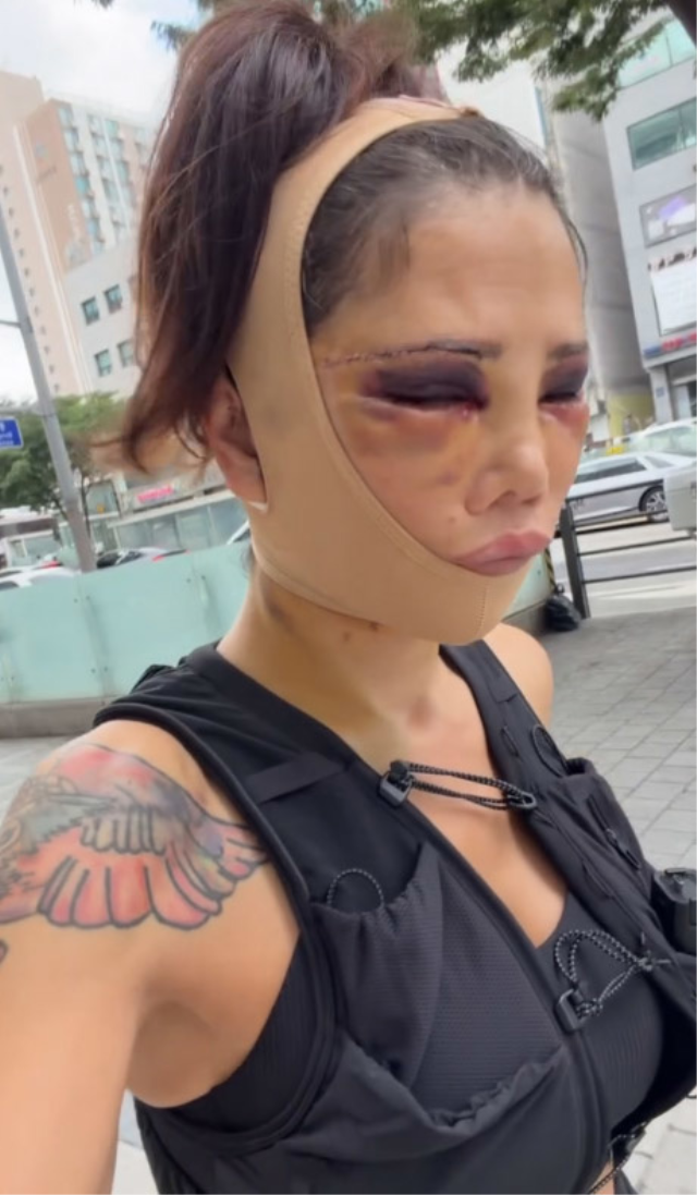 Eski Survivor yıldızı Didem Ceran tanınmaz halde