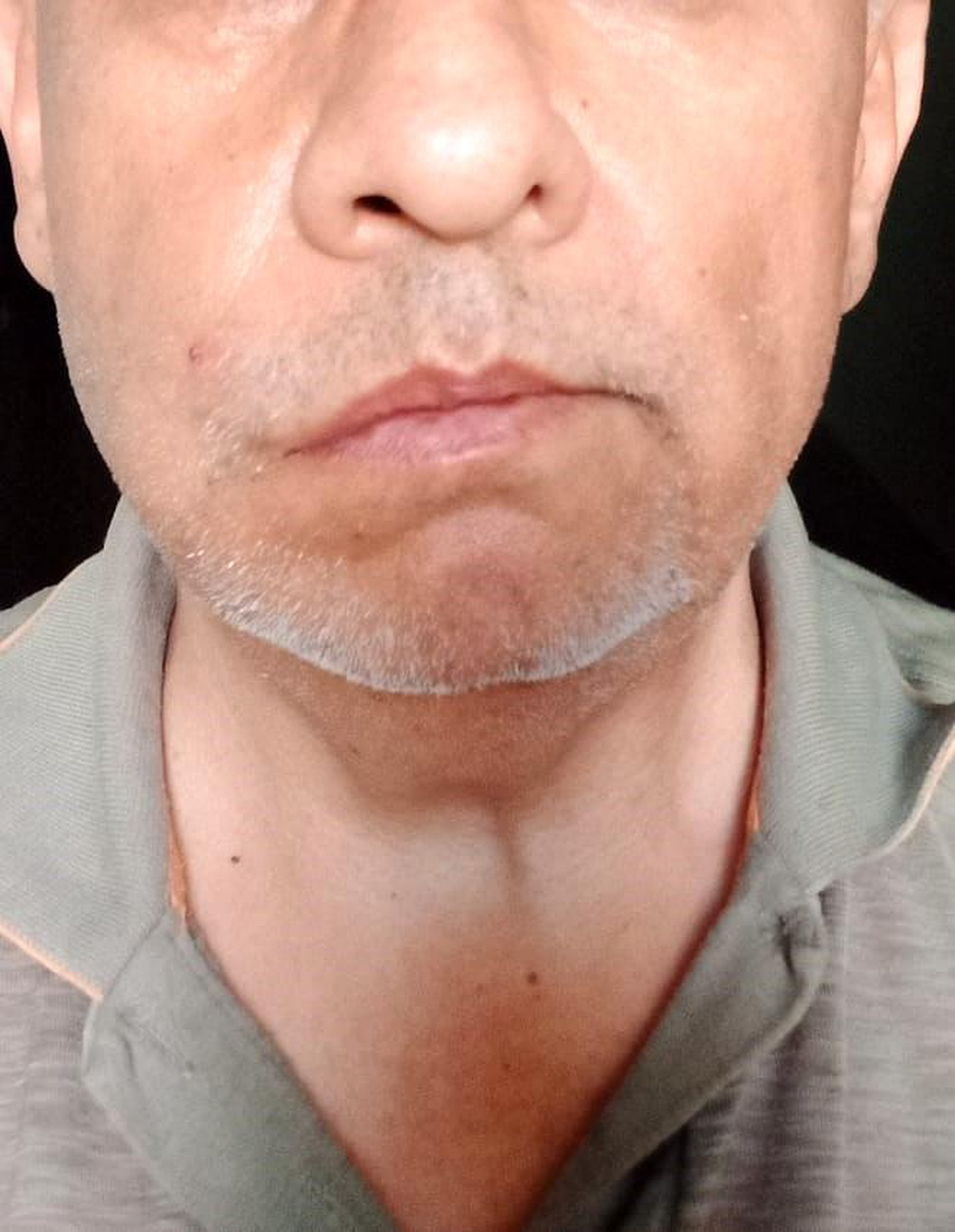 Otobüste İkram Kavgası: Doktor Yaralandı