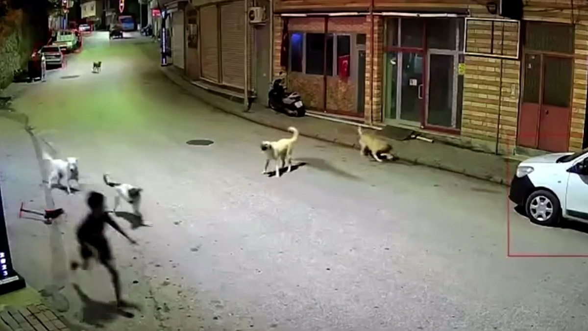 Çocuğa Sahipsiz Köpek Saldırısı