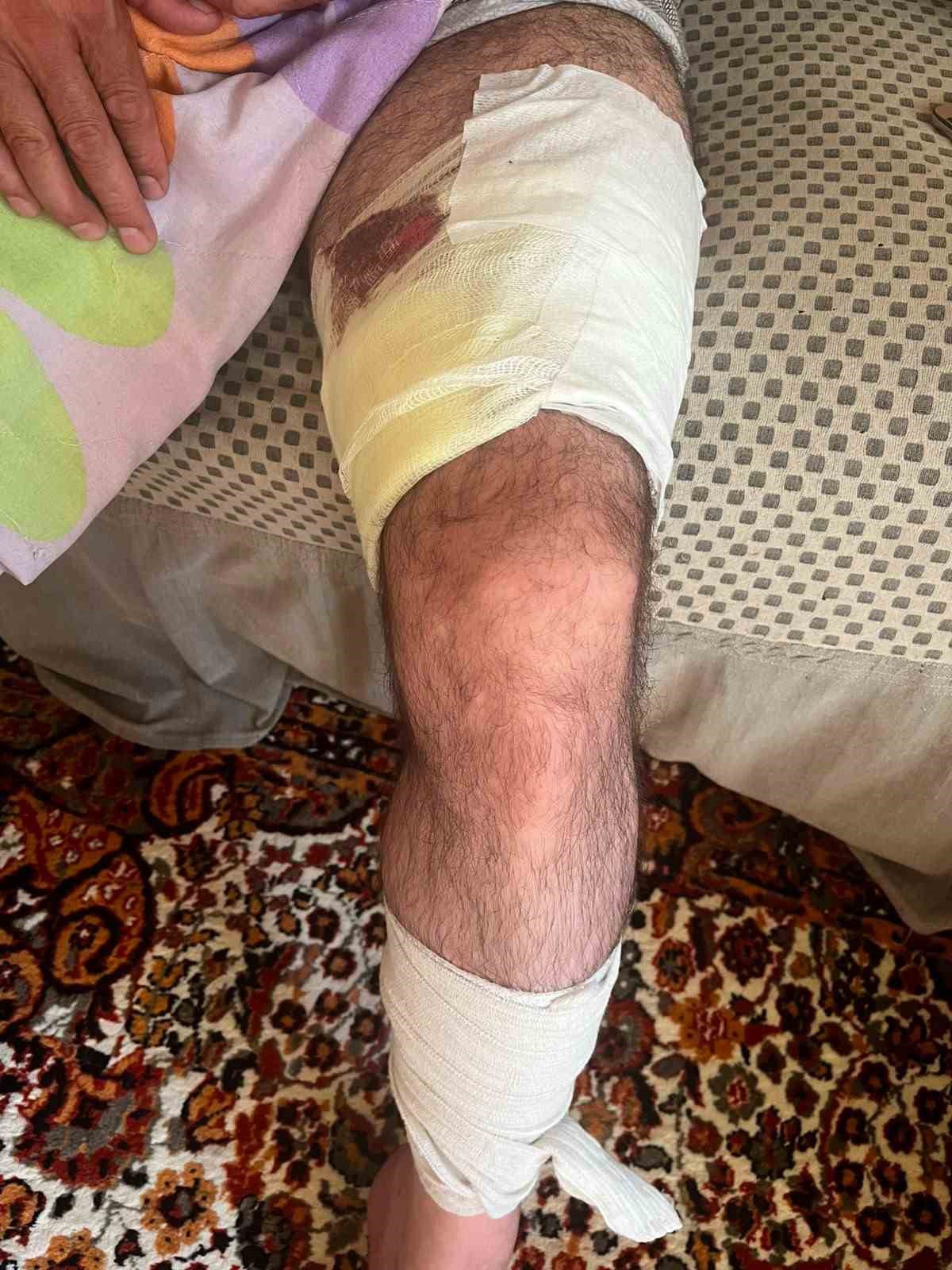 Arazi Anlaşmazlığı Kanlı Bitti: 1 Yaralı