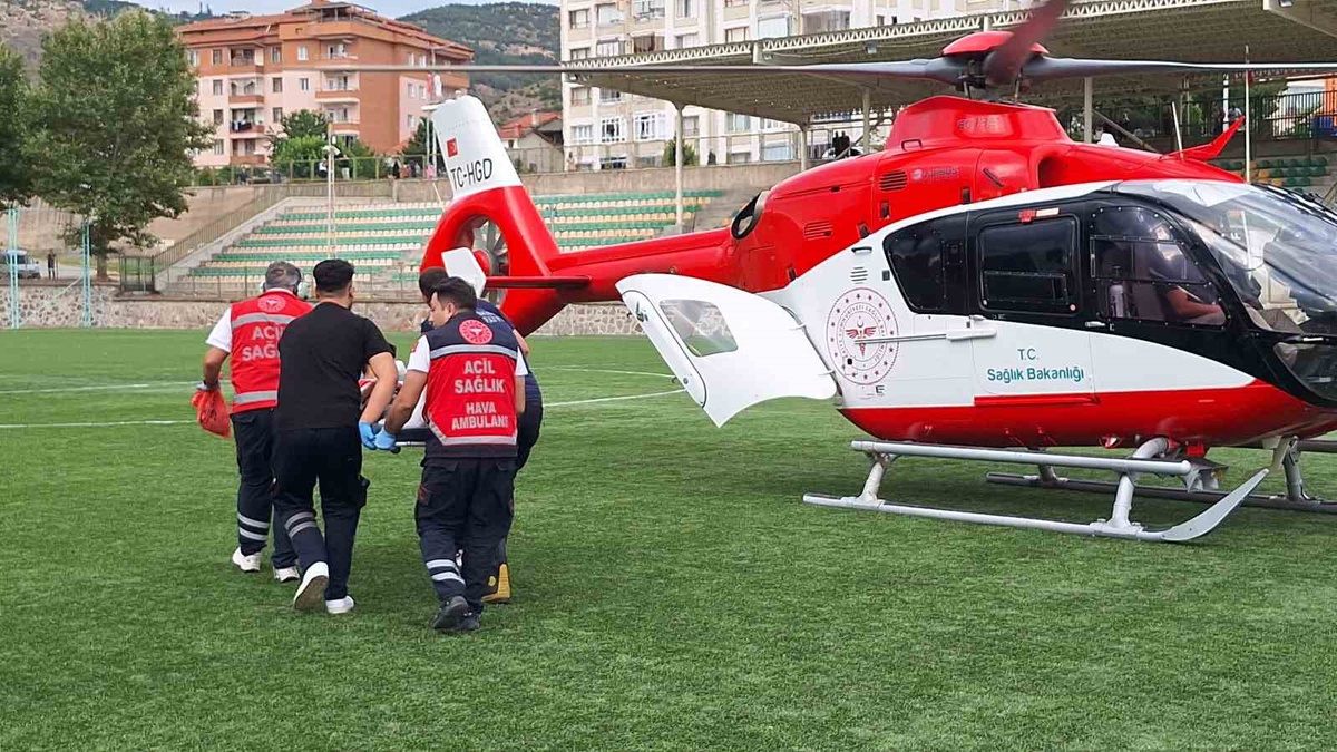Kapıya Sıkışan Çocuğun Parmağı Koptu