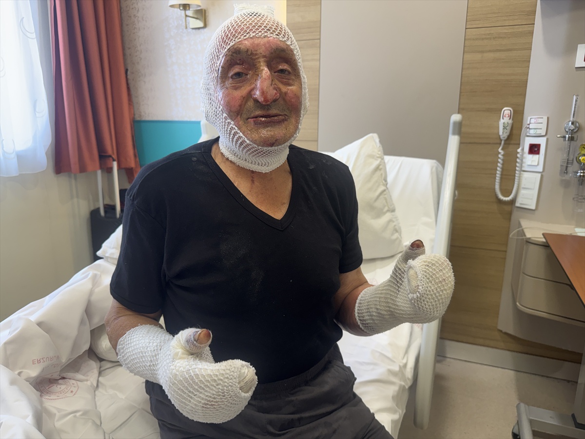 Erzurum\'da çay demlerken dalgınlık felaketi