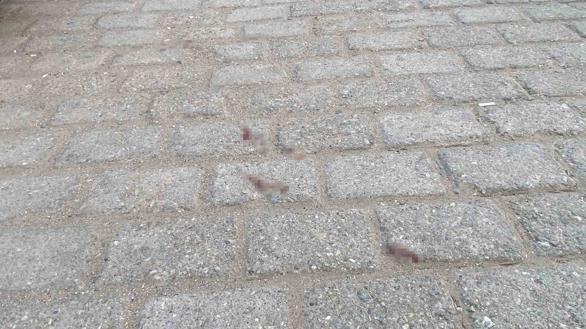 Damat Kayınpederi Tarafından Tüfekle Vuruldu