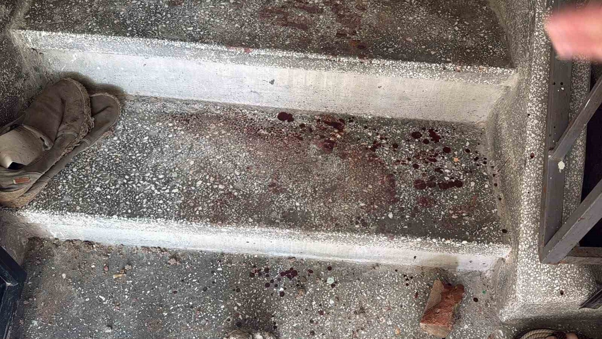 Eskişehir\'de Kavga: 2 Polis ve 7 Yaralı