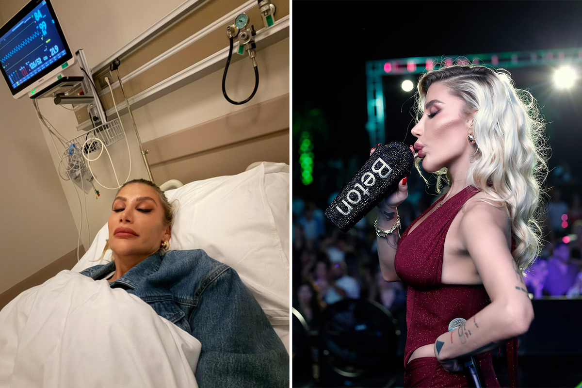 İrem Derici’nin çene görüntüsü şaşırttı! Herkes dolgu sandı ama gerçek ortaya çıktı