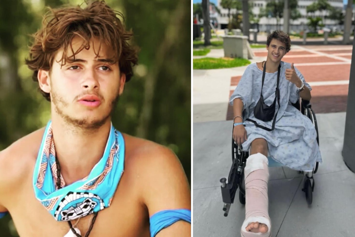 Survivor\'da bacağını kaybeden yarışmacıdan yeni paylaşım: Yeni hayatına alışmaya çalışıyor
