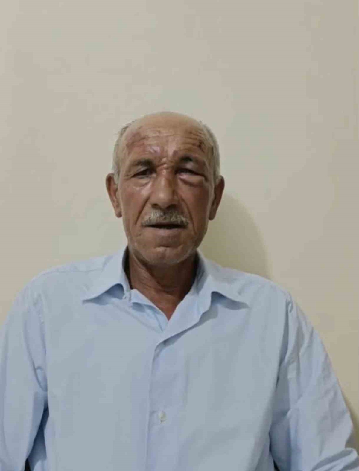 Muhtar Saldırıya Uğradı, 2 Şüpheli Tutuklandı