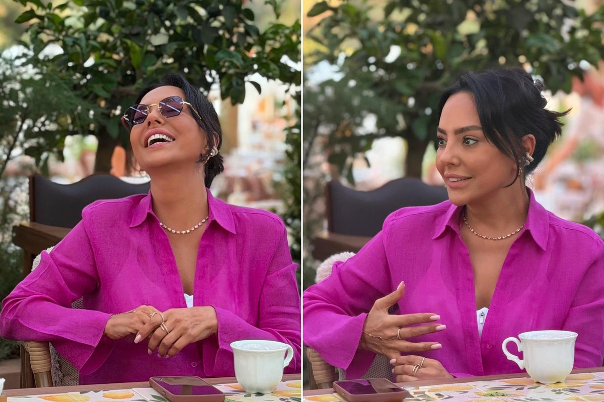 Estetik operasyon için 10 milyon TL veren Ebru Gündeş\'in son hali ortaya çıktı