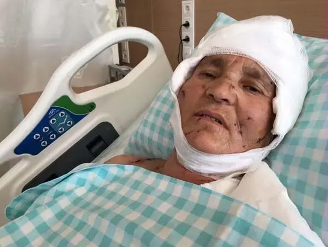 Yaşlı kadın evinin önünde dehşeti yaşadı: Yargıtay'dan köpek saldırısında emsal karar