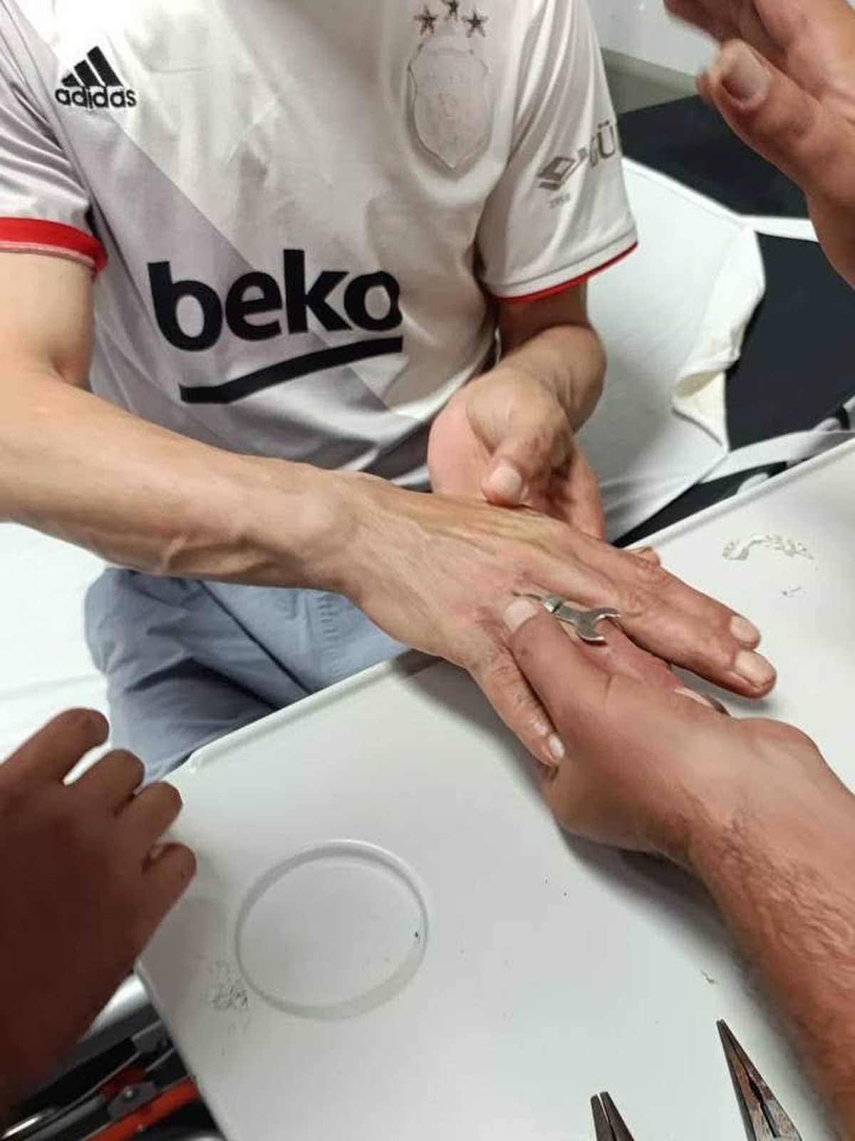 Hatay\'da Yüzük Sıkışması Kurtarıldı