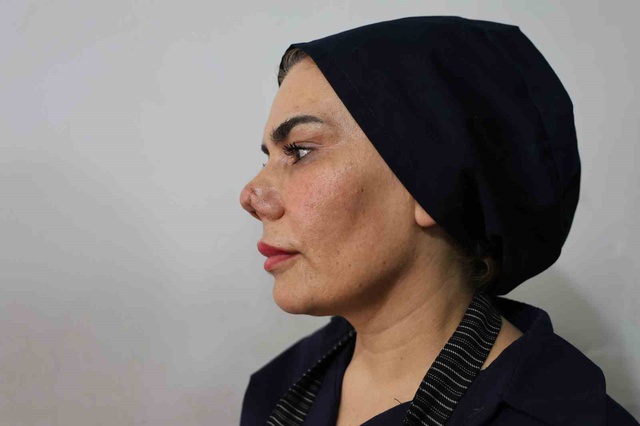 Burun estetiği faciayla sonuçlandı: Kadının hayatı kabusa döndü