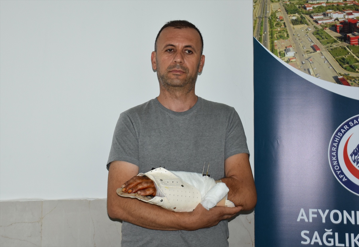 Tarlada Kaza: Bilek Ameliyatla Kurtarıldı
