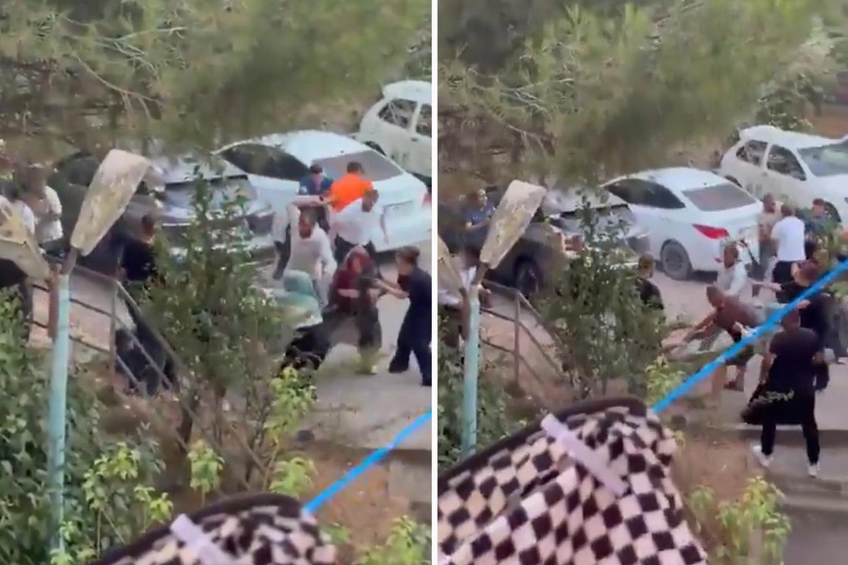 İddia vahim! Köpeğini gezdiren küçük kızı bıçakladı, annesinin kolunu kırdı