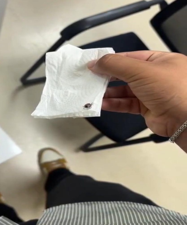 Eskişehir'de Çocuğun Kulağından Kene Çıkarıldı