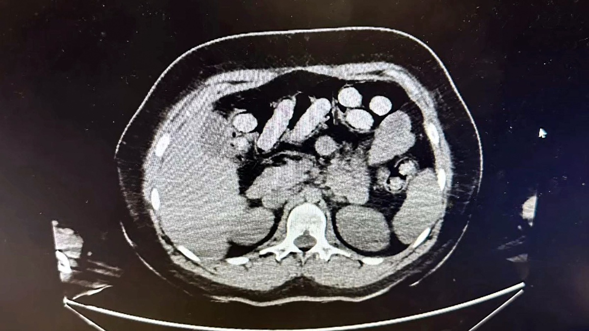 Otogarda mide operasyonu: 1,5 kilo metamfetamin ele geçirildi