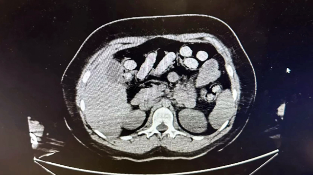 Midelerinde 1,5 kilo uyuşturucu çıkan 2 kadın tutuklandı
