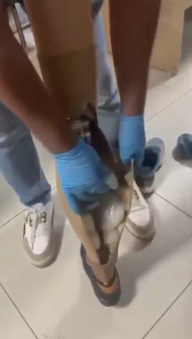 Suriyeli şahsın protez bacağından çıkanlar akıllara durgunluk verdi