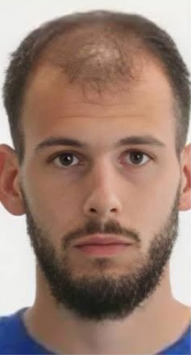 Türkiye'de saç ektiren Hırvat futbolcunun son hali olay oldu