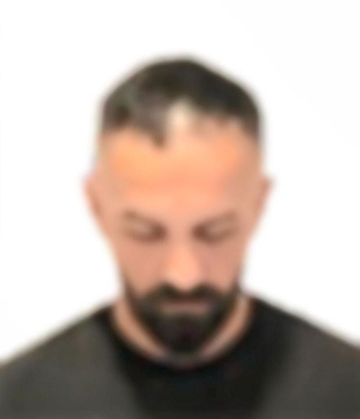 Güzellik Merkezinde Gizli Kamera Skandalı