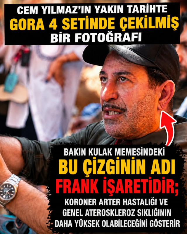 Cem Yılmaz'ın kalp krizi sonrası herkes bu detaya takıldı