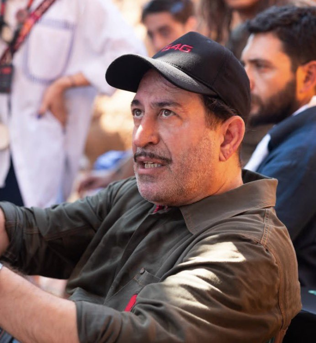 Cem Yılmaz'ın kulağındaki detay gündem yarattı! Uzman isim tartışmaya noktayı koydu