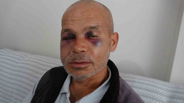 Adana Kozan'da duyma engelli adama sokak ortasında dayak atıldı, 1 kişi gözaltına alındı