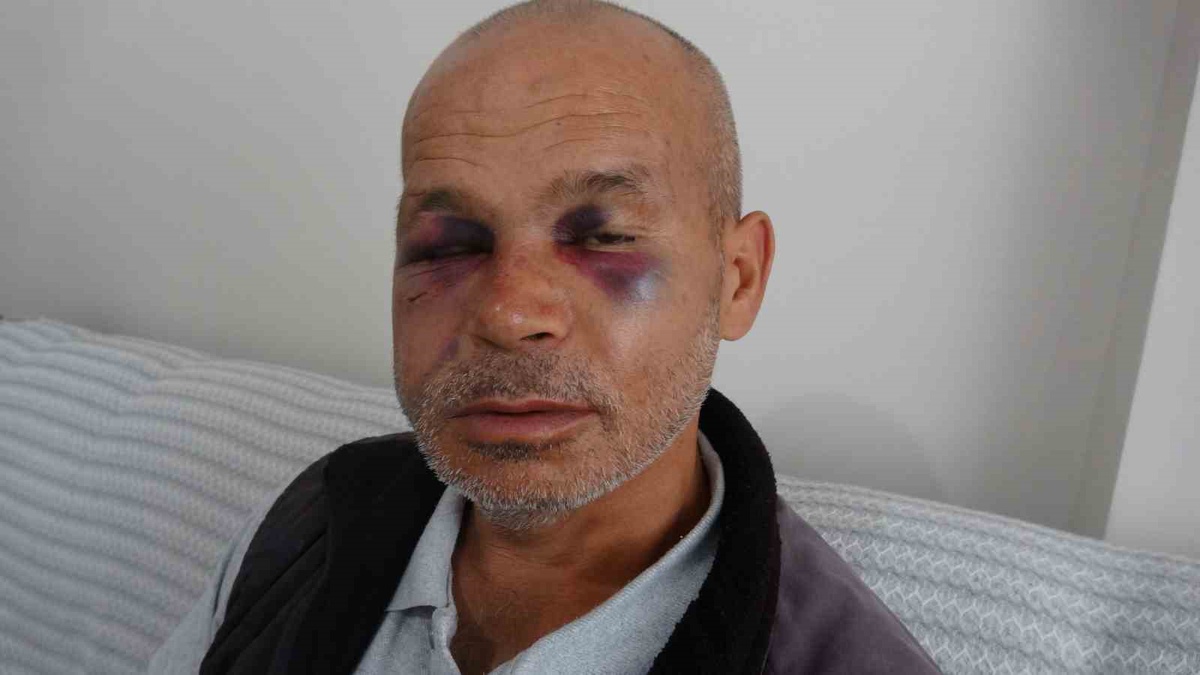 Kozan\'da engelli adamı darbeden şüpheli gözaltına alındıktan sonra serbest bırakıldı