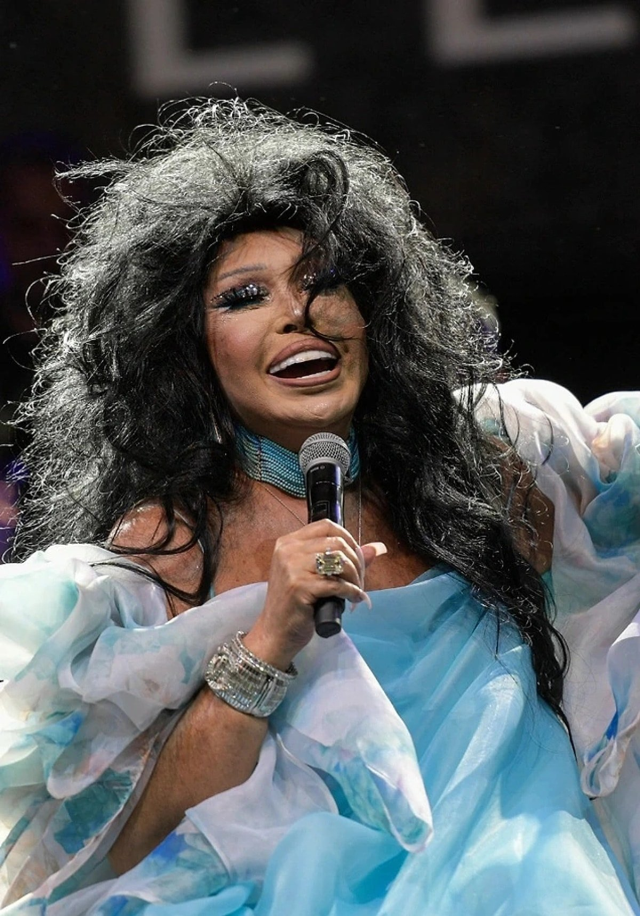 Bülent Ersoy’un lolita estetiği sonrası son hali: Bana abla demeyin