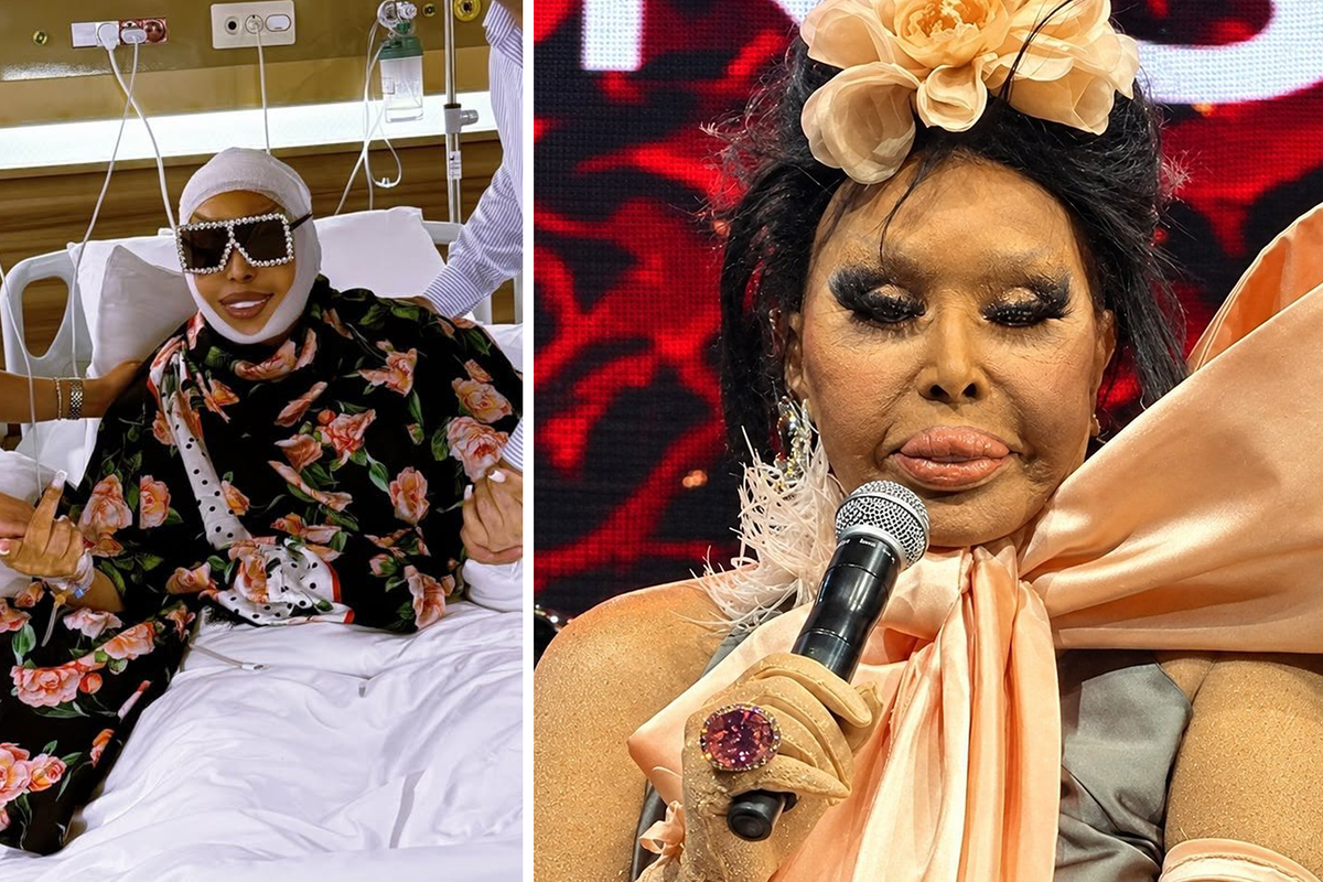 Bülent Ersoy’un lolita estetiği sonrası son hali: Bana abla demeyin