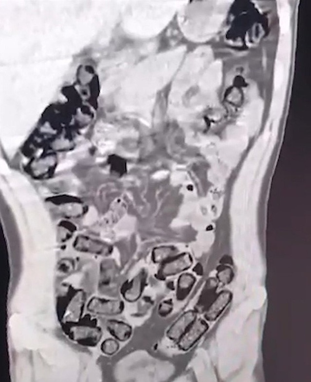 Muş'ta otobüsle gelen İran uyruklu 3 şüpheli tutuklandı, 1 kilo metamfetamin ele geçirildi