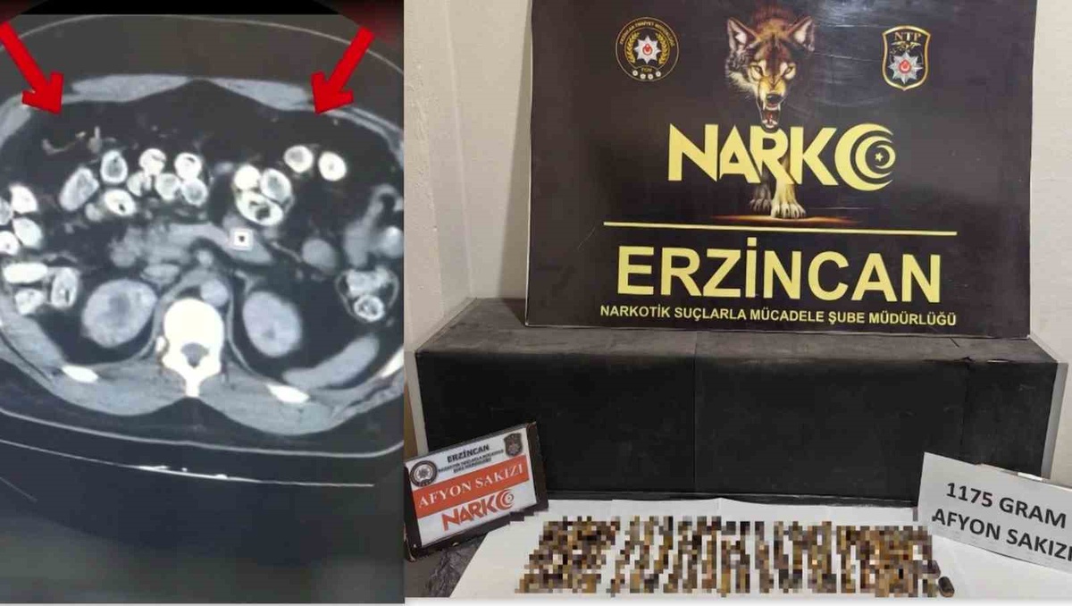 Erzincan’da uyuşturucuyu vücutlarında taşıyan 3 şüpheli yakalandı